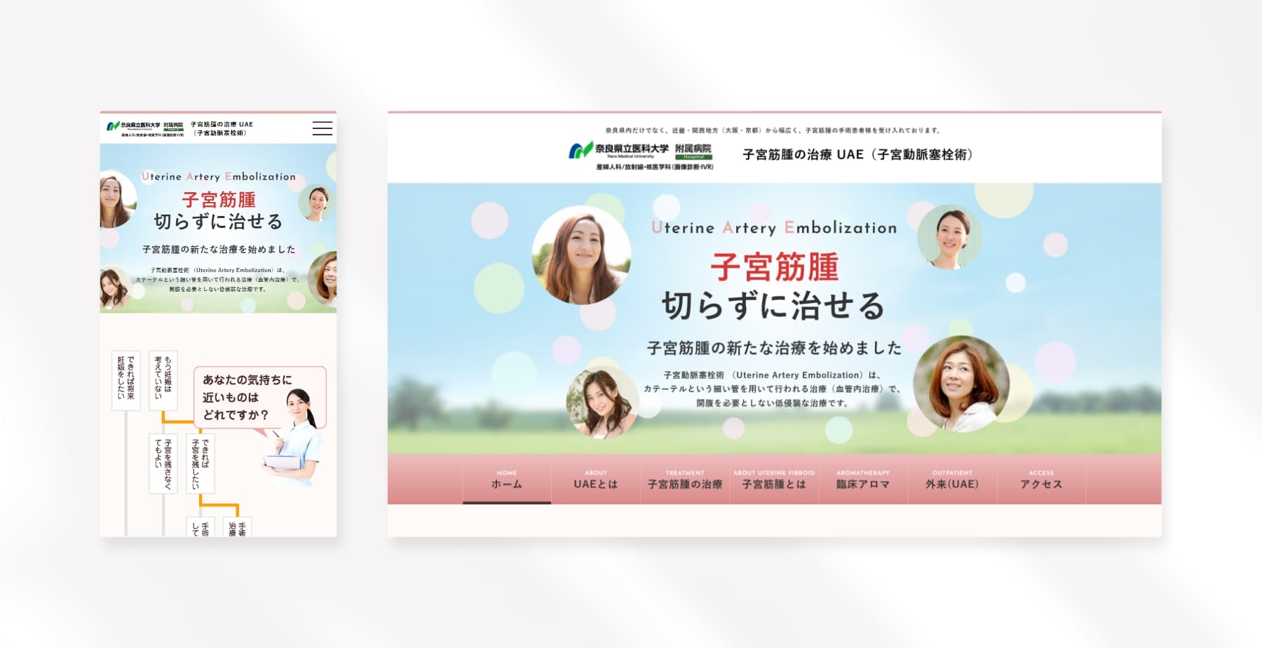 奈良医大付属病院 子宮筋腫の治療UAE